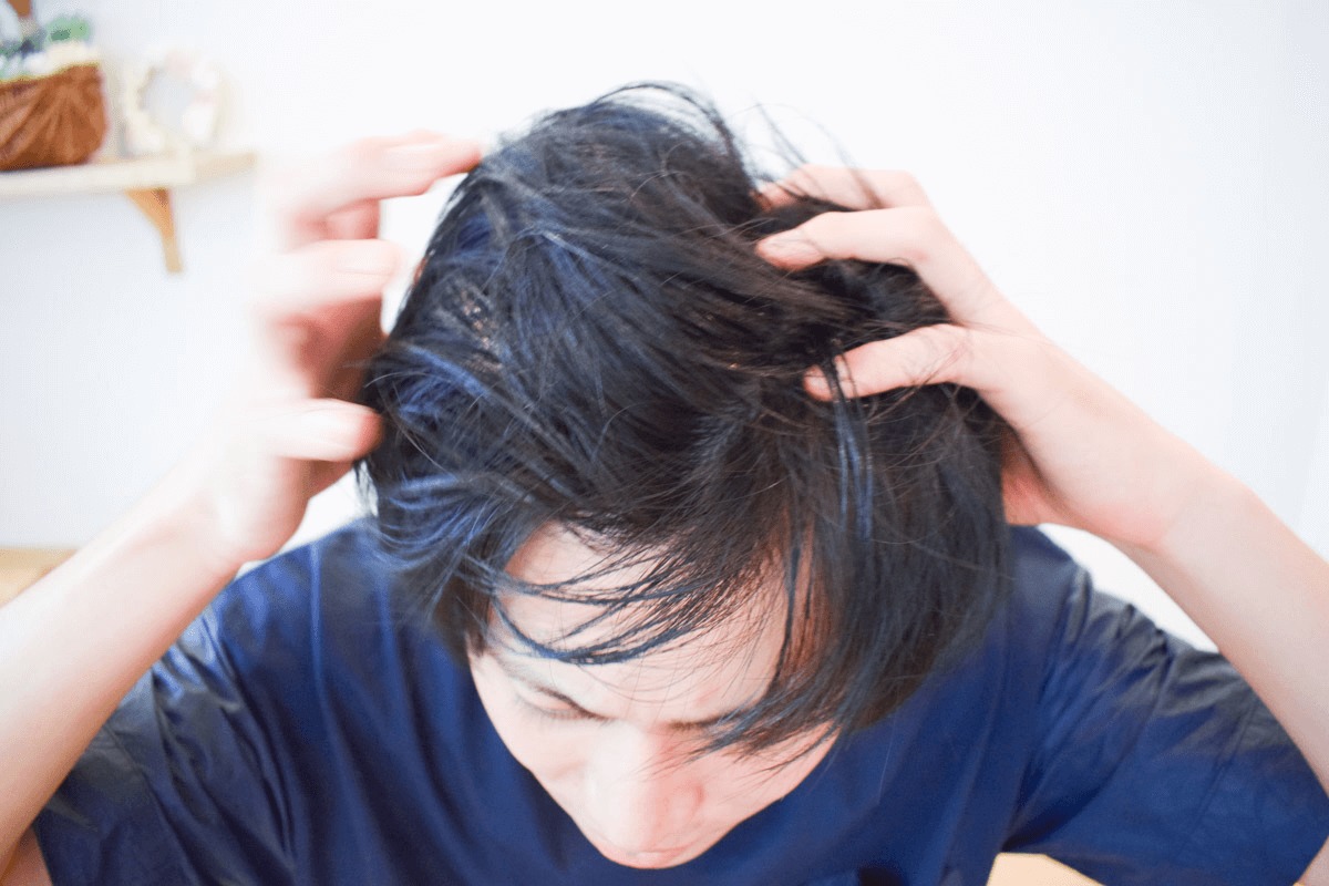頭皮がクサい！男の不快な頭皮臭の原因と正しい消臭方法・ケア対策のサムネイル